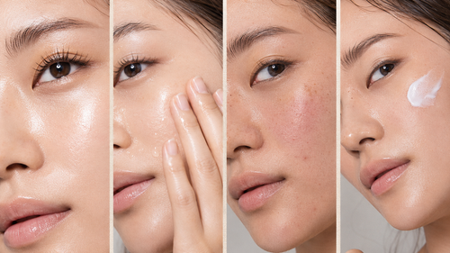 Skin Concerns, Explained